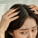 درد ریشه مو چه دلایلی دارد؟